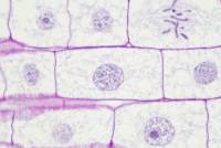 Mitose dans une racine de Blé (cellule en interphase) x200